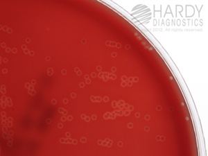 Arcanobacterium haemolyticum NEW Prepared Media Template