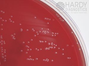 Arcanobacterium haemolyticum NEW Prepared Media Template