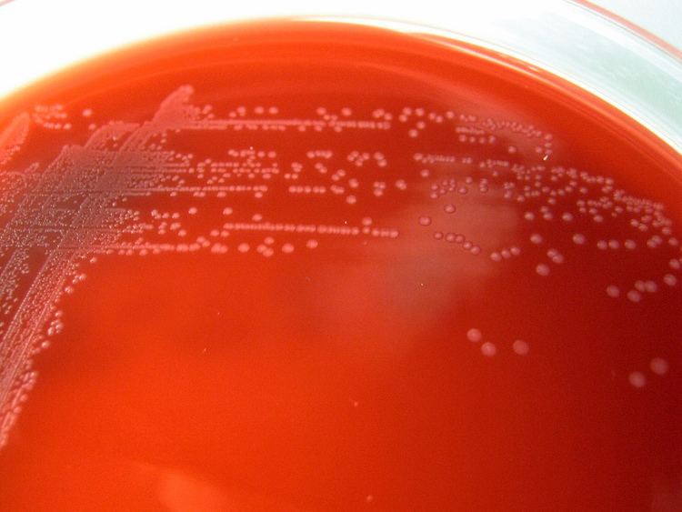 Arcanobacterium haemolyticum Arcanobacterium haemolyticum Small colonies after 48 hour Flickr