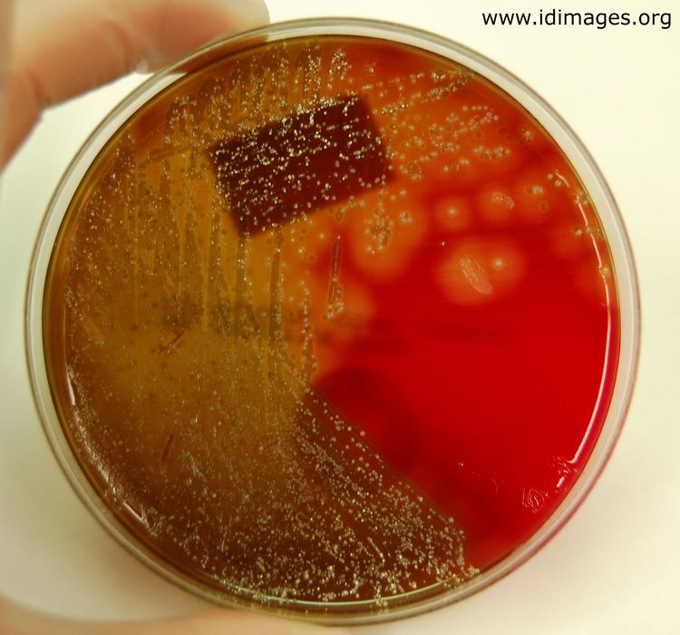 Arcanobacterium haemolyticum Arcanobacterium Images Partners Infectious Disease Images