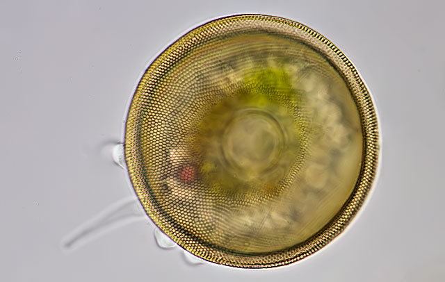 Arcella Arcella vulgaris Microworld