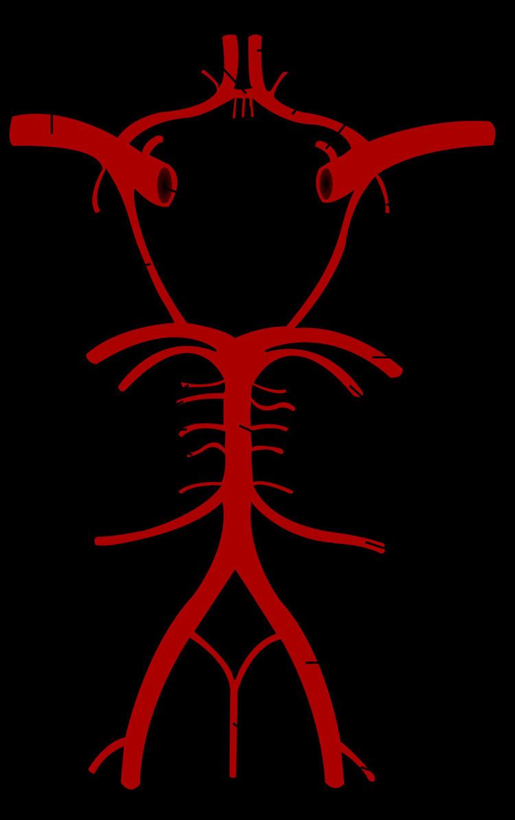 Artery of Percheron