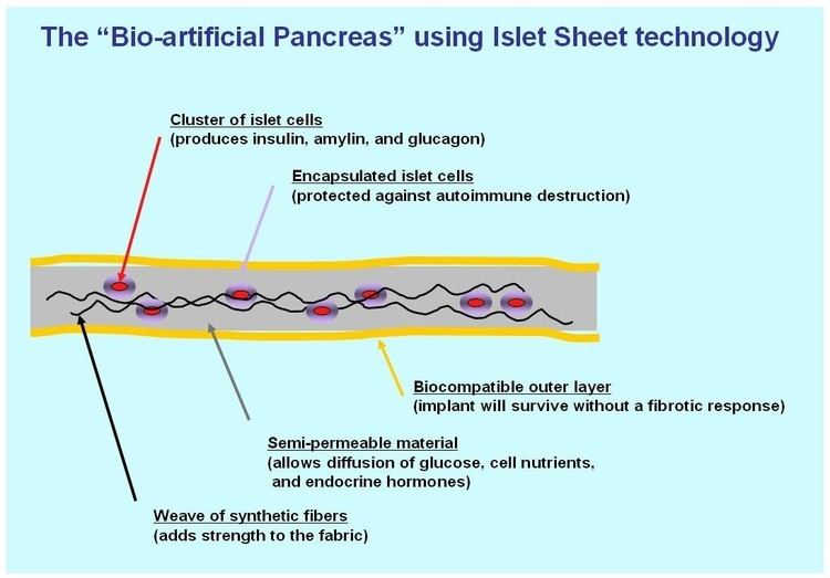 Artificial pancreas