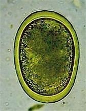 Ascaridia parasitipedianetimagesstoriesendoparaNematod