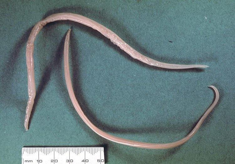 Ascaris Ascaris suum Pig roundworm Ascaris lumbricoides