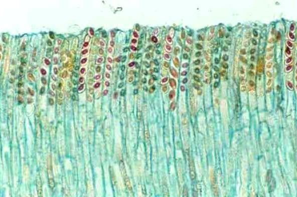 Ascospore pollenutulsaeduSporesasciascosporesjpg