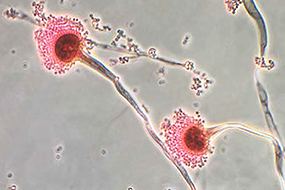 Aspergillus Aspergillosis Types of Fungal Diseases Fungal Diseases CDC