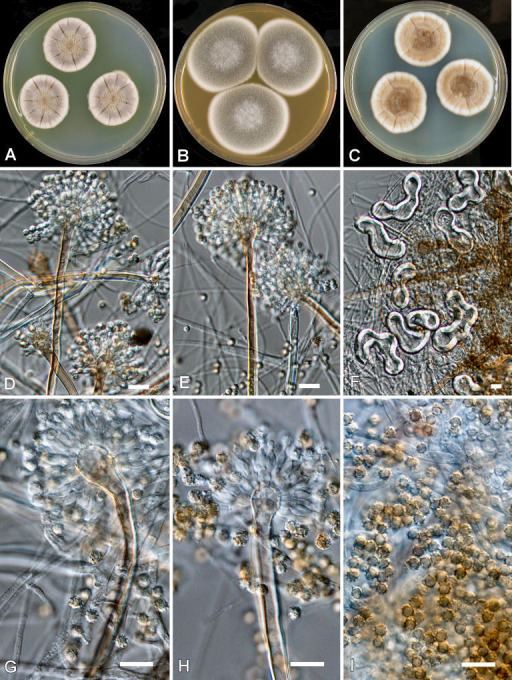 Aspergillus calidoustus Aspergillus calidoustus AB Colonies at 25 C after Openi