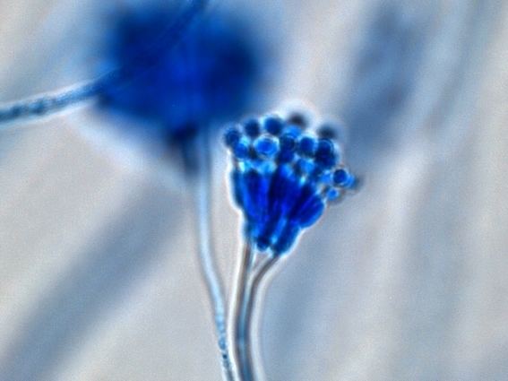 Aspergillus calidoustus Aspergillus Conidia Conidia Volvoab