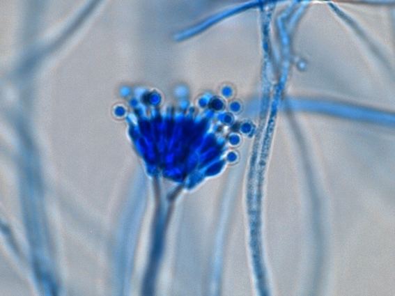 Aspergillus calidoustus Fun With Microbiology What39s Buggin39 You Aspergillus calidoustus