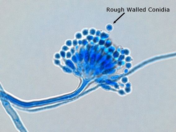 Aspergillus calidoustus Aspergillus Slide Labeled 20553 DFILES