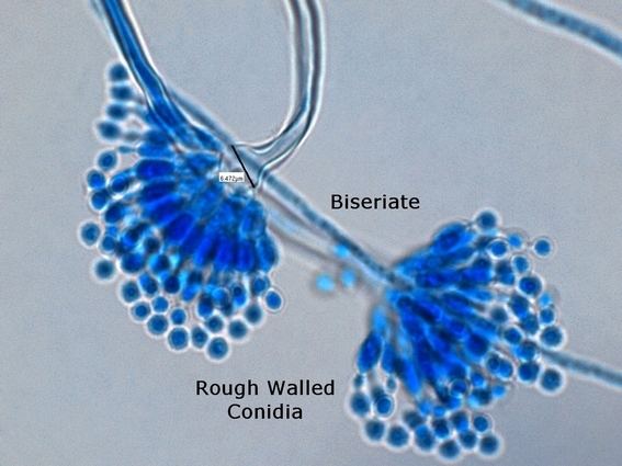 Aspergillus calidoustus Fun With Microbiology What39s Buggin39 You Aspergillus calidoustus