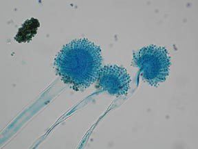 Aspergillus flavus A Resident39s Fungal Morphology