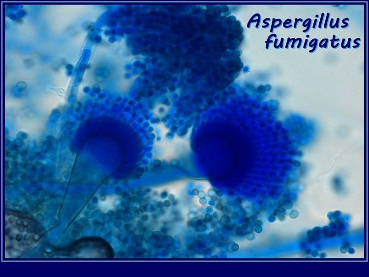 Aspergillus fumigatus Fun With Microbiology What39s Buggin39 You Aspergillus fumigatus