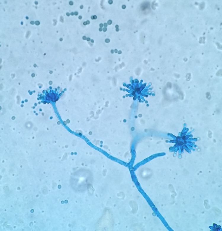 Aspergillus glaucus Aspergillus glaucus Chaetomium Queen Chaetomium Queen