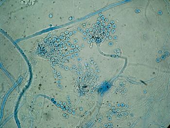 Aspergillus glaucus 1931751109hornemanngermandiplabbTesa6Aspe