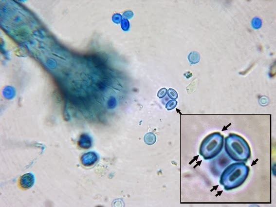 Aspergillus glaucus Fun With Microbiology What39s Buggin39 You Eurotium herbariorum