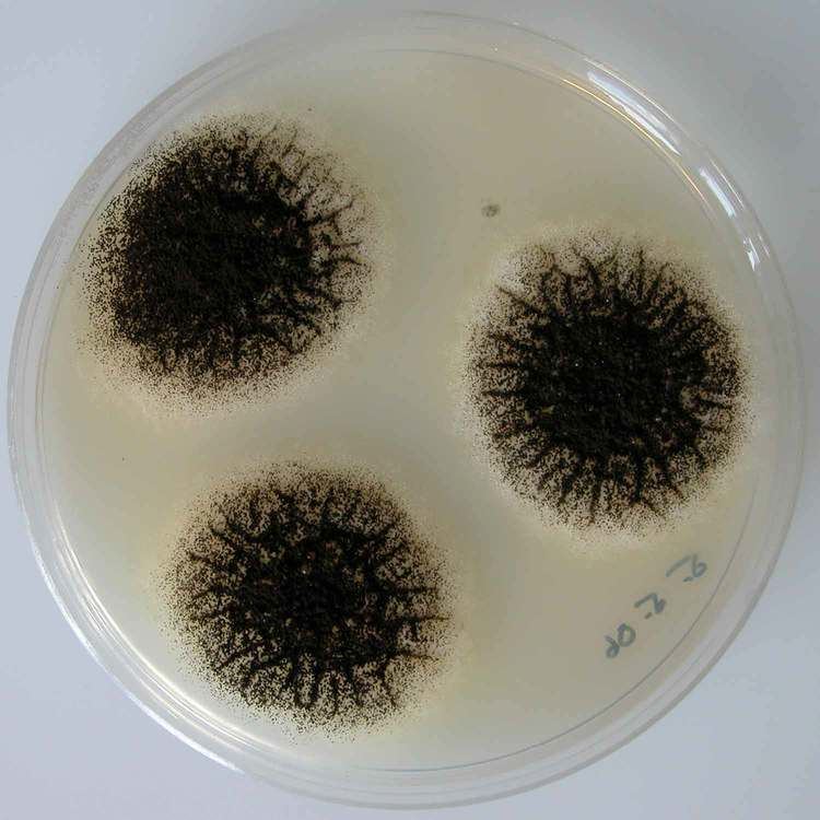 Colony morphology of Aspergillus niger