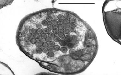 Aureococcus anophagefferens Thinsection image of Aureococcus anophagefferens cell Figure 3