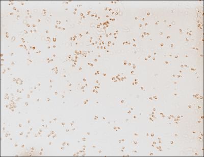 Aureococcus anophagefferens Brown Tide Aureococcus anophagefferens Cells image EurekAlert
