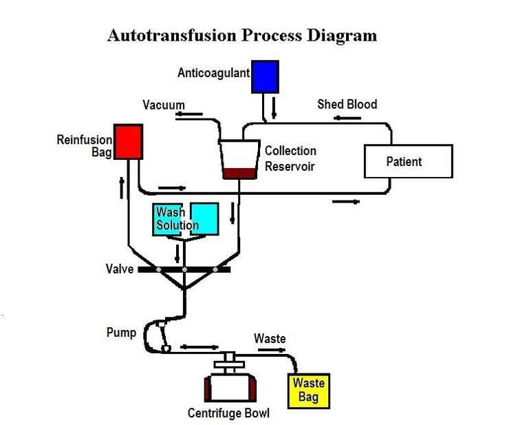 Autotransfusion