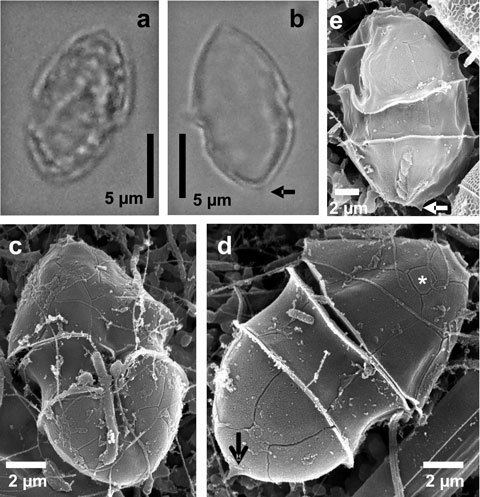 Azadinium spinosum Un nuevo registro de Azadinium spinosum Dinoflagellata en el