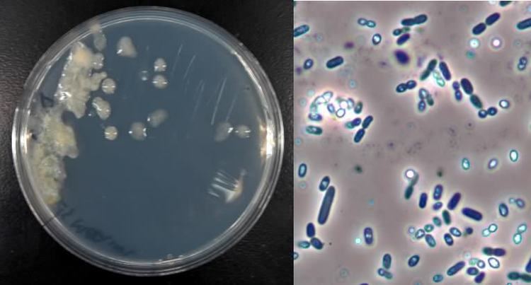 Azotobacter Azotobacter Beneficial Microbes