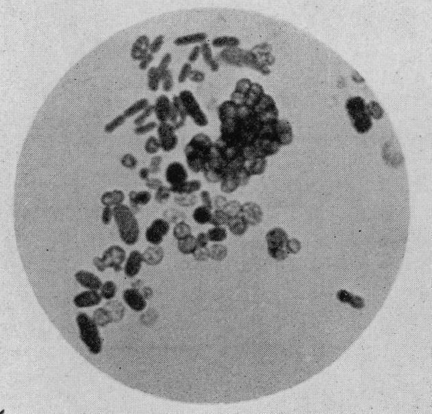Azotobacter httpsuploadwikimediaorgwikipediacommonscc