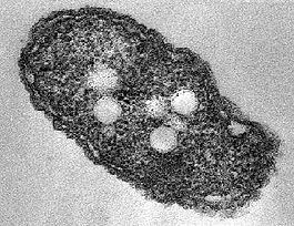 Azotobacter vinelandii Azotobacter vinelandii