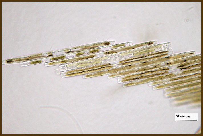 Bacillaria paxillifer MicUK Slipping and Sliding Bacillaria paxillifer