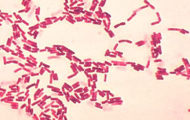 b subtilis endospore stain