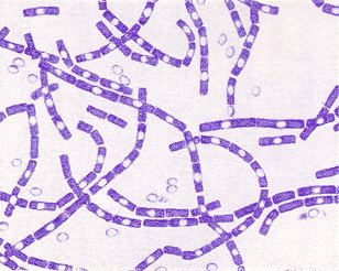 Bacillus Bacillus anthracis and anthrax