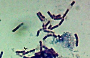 Bacillus atrophaeus Why An Expiration Date for Titanium Implants Part 4 Parsa Zadeh