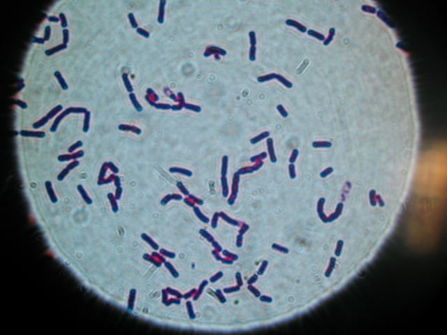 Bacillus cereus Bacillus cereus