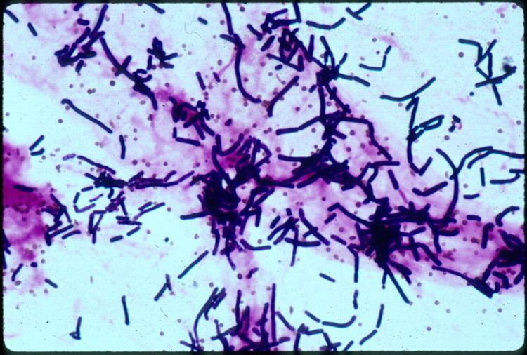 Bacillus cereus Bacillus cereus a Volatile Human Pathogen