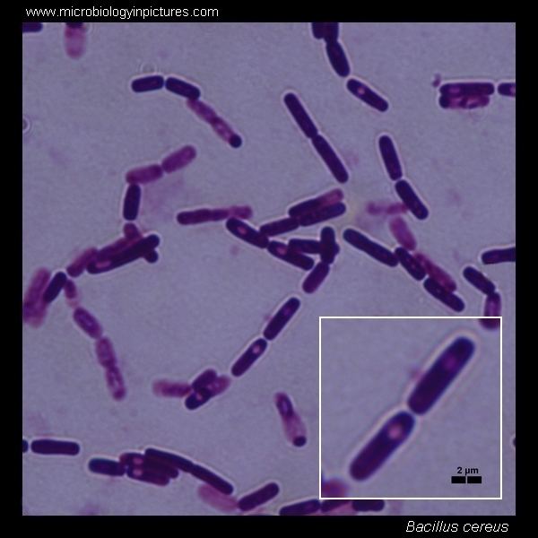 Bacillus cereus Bacillus cereus microscopy Bacillus cereus Gramstain and cell