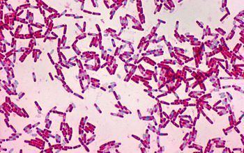 Bacillus cereus Bacillus cereus