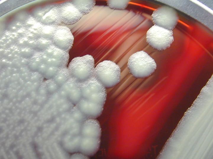 Bacillus cereus Bacillus cereus Wikipedia