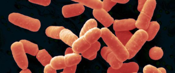 Bacillus coagulans Introducing A New Probiotic Bacillus Coagulans Jason Tetro