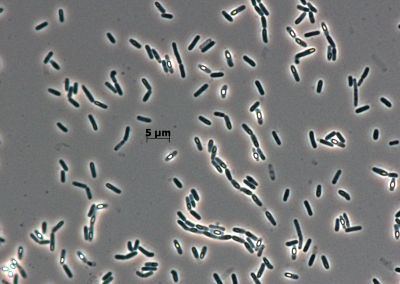 Bacillus firmus wwwdsmzdemicroorganismsphotosDSM30614jpg