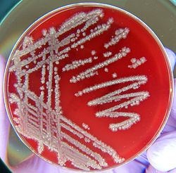 Bacillus licheniformis httpsuploadwikimediaorgwikipediacommonsthu