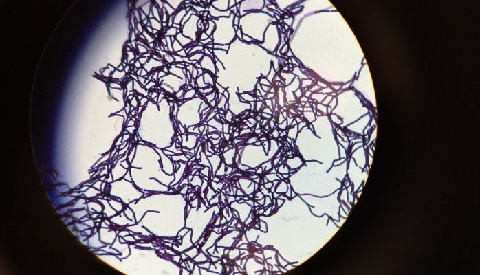 Bacillus megaterium, a genus of gram-positive, rod-shaped bacteria