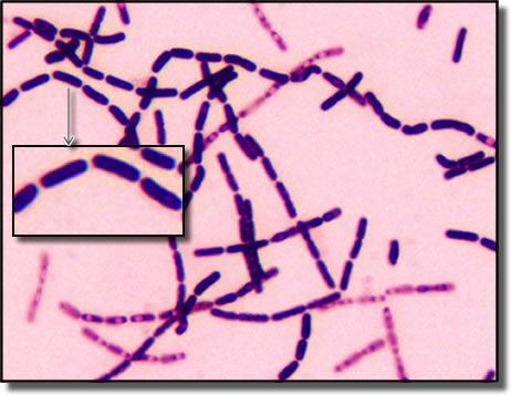 Bacillus (shape) Bacteria6jpg