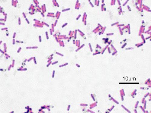 Bacillus (shape) Bacillus Wikipedia