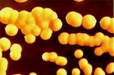 Bacillus sphaericus webmstedumicrobiobio2211999bsphaericusjpg
