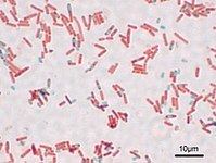 Bacillus subtilis httpsuploadwikimediaorgwikipediacommonsthu