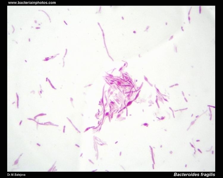 Bacteroides Bacteroides fragilis