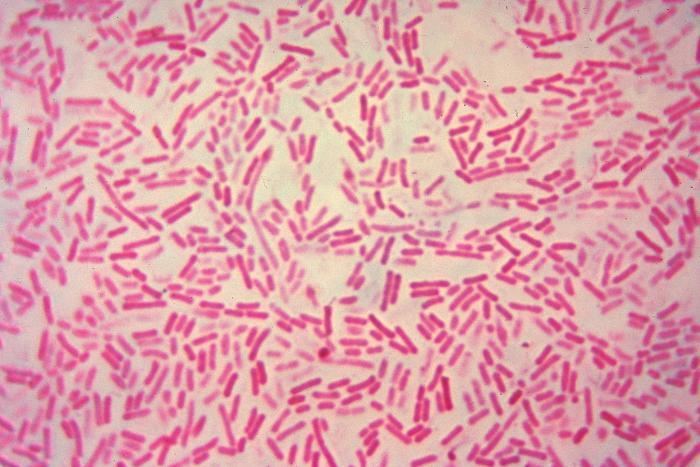 Bacteroides FileBacteroides hypermegas gram stainjpg Ganfyd