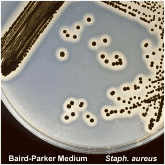 Baird–Parker agar microbeonlinecomwpcontentuploads201505Baird