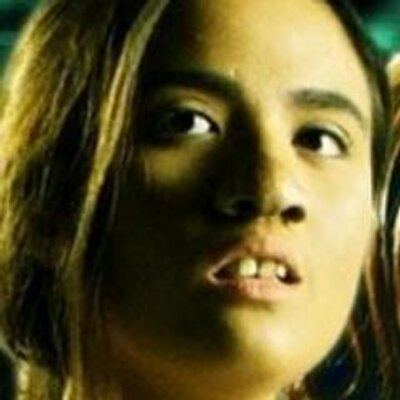 Sunshine Dizon plays the role of Bakekang with an ugly nose and teeth.